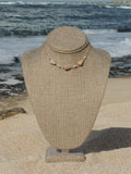Cone Shell Choker Necklace